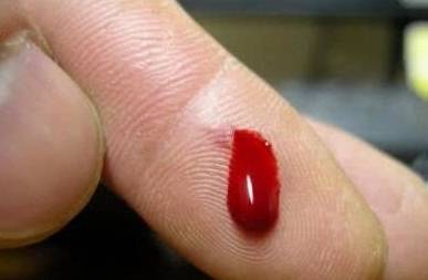 疱疹怎么引起的神经痛 7e25d896f94a4866bcb6bf07b0691831.jpeg