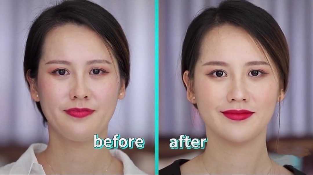 下巴|看完这篇再决定要不要打瘦脸针！不用P图双下巴也能byebye