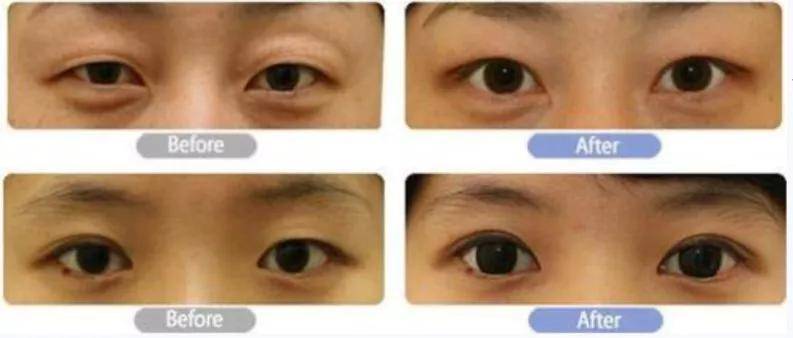 李惠利|女明星最绝大鼻头变身记！娜扎do鼻子前应该找她取经1000次...