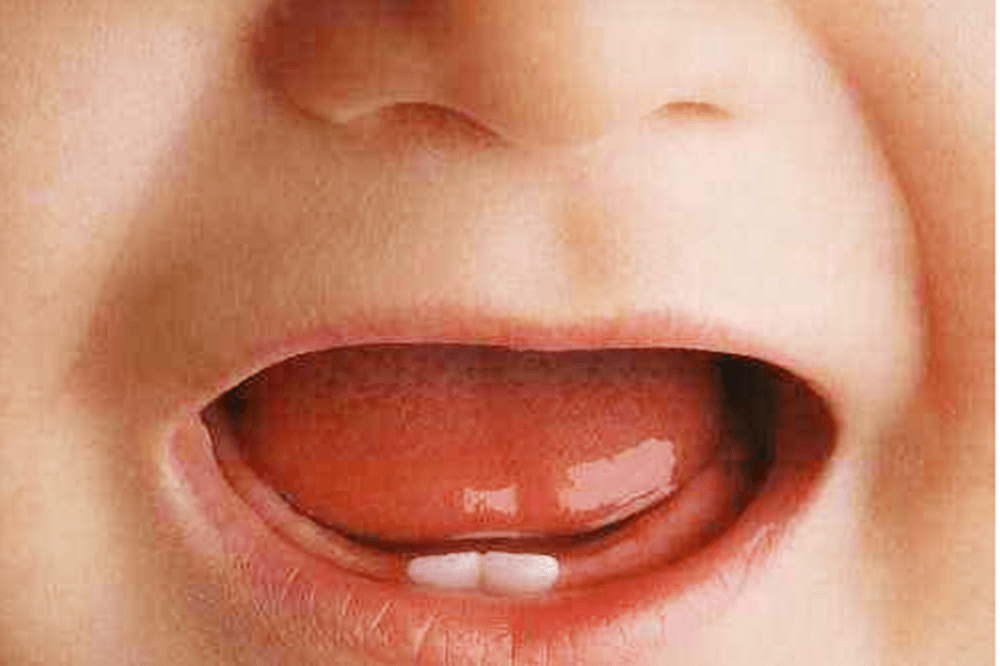 78bd0002271149eba98204db31f886db.png