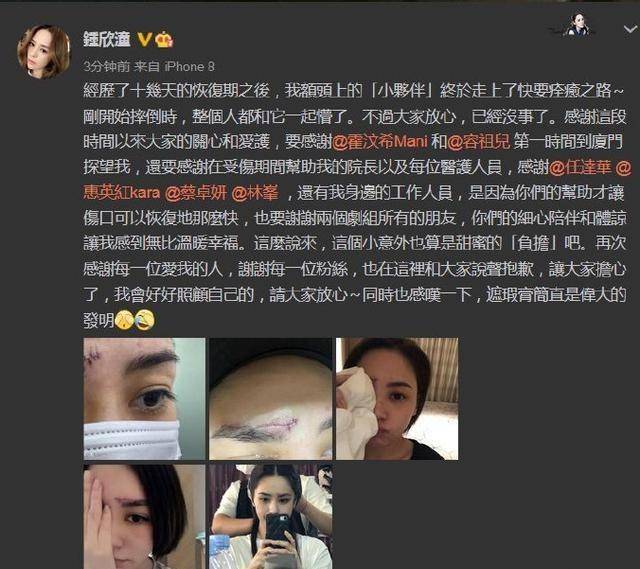 伤疤|收起你的廉价同情心，以疤痕为丑的时代即将结束，伤痕美学兴起！