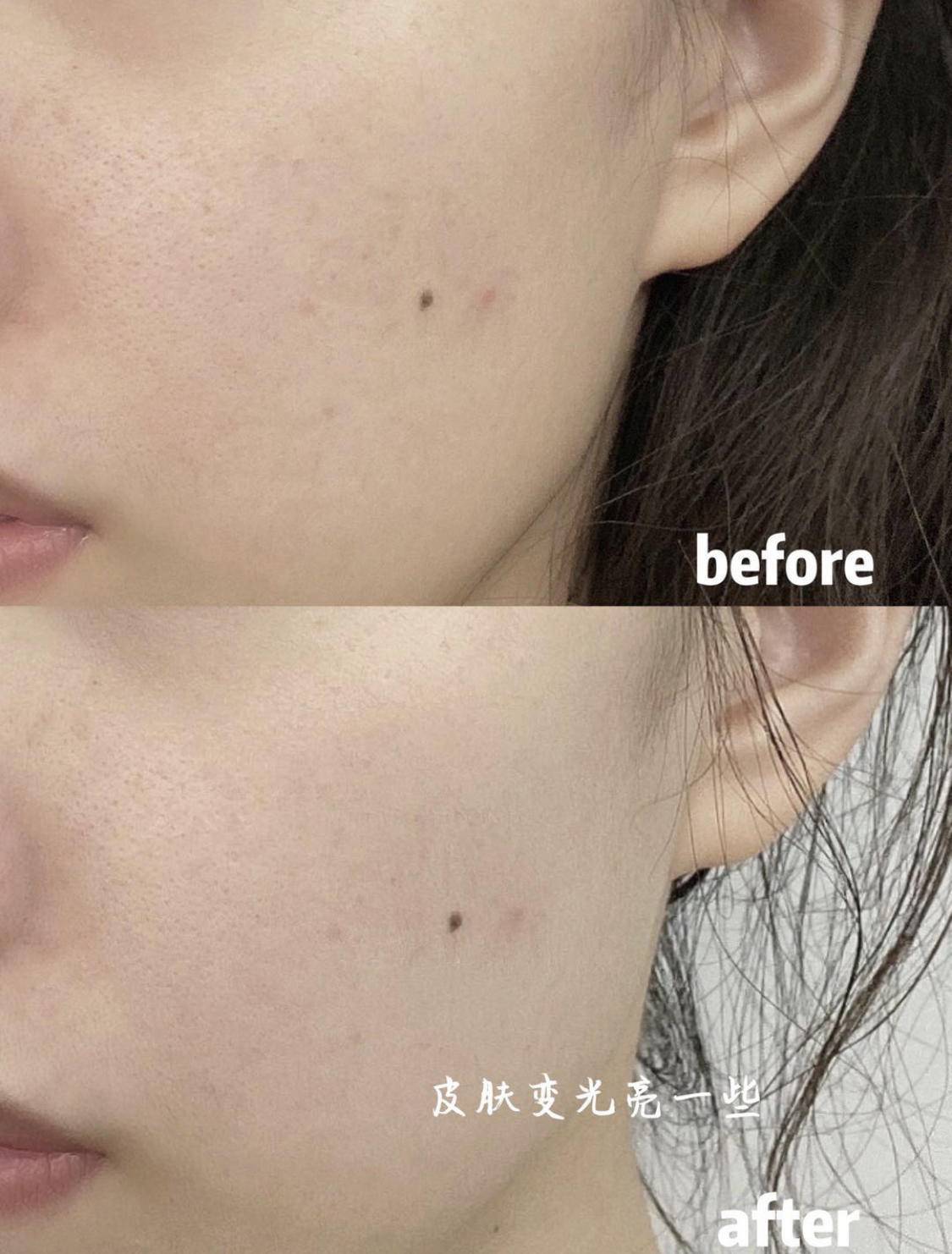 肌肤|杨幂，赵丽颖是吃了什么仙丹吗？她们的“逆龄”到底怎么操作的