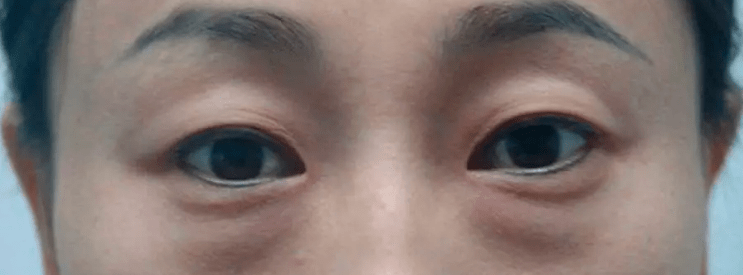 眼睛|300亿纯天然公主“下嫁”3年,40岁生两女还艳压无数小花