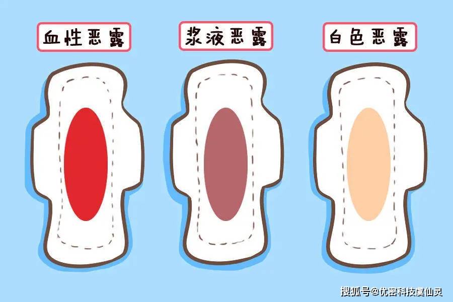 女人良伴虞仙灵 —— 产后恢复篇_手机搜狐网