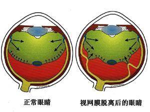 3197cbbde1a94a11a69c3e608968cbde.jpeg