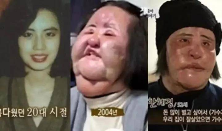 娃娃|那些13岁开始整容的人，花了400万整成凡尔赛娃娃的模样