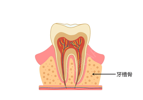 牙齿缺失后牙槽骨就像水土流失,会出现不同程度的废用性萎缩和吸收.