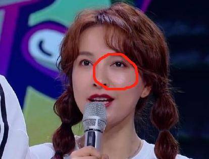 切换|吴昕御姐路线切换失败，皮肤松弛瘦成火柴人，情路坎坷状态难回春