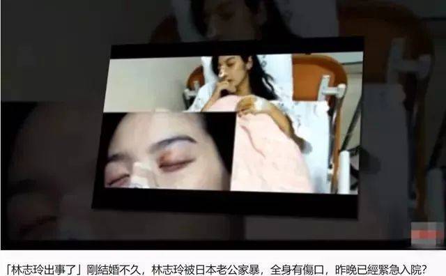生不出娃被日本老公家暴?林志玲力秀恩爱打脸质疑