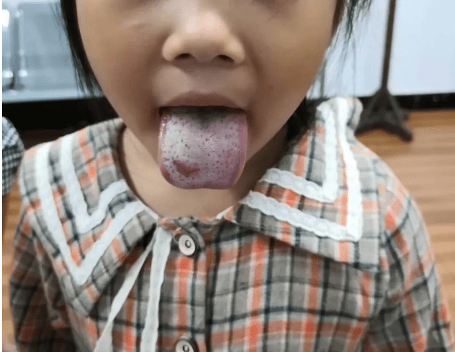 小儿|消化不好,这是父母喂养不当所致,该醒醒了小儿脾胃虚弱