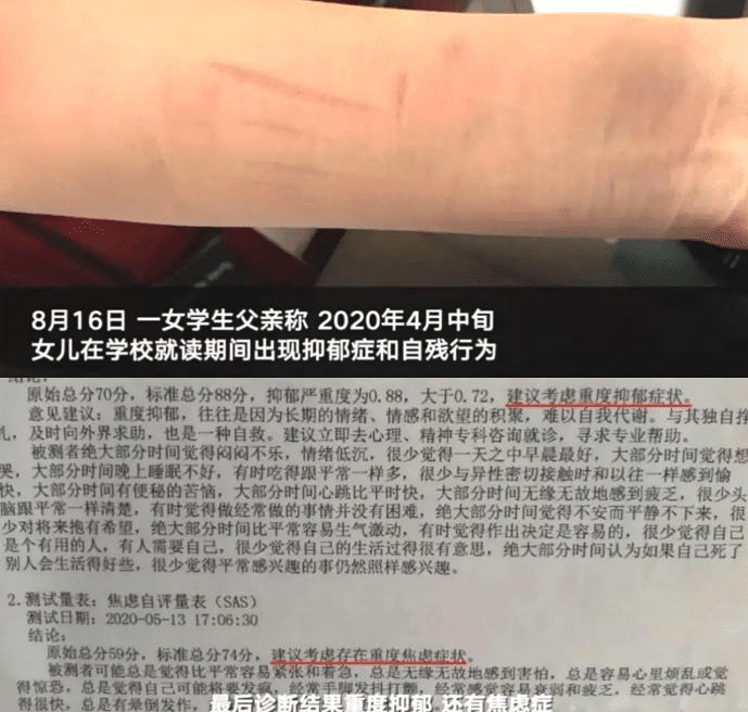 教师猥亵女学生致其抑郁自残判刑8年禁止从业4年网友判轻了