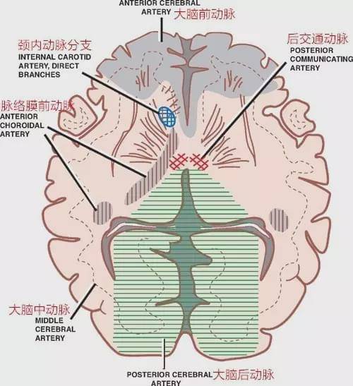 认识脉络膜前动脉:从解剖到临床