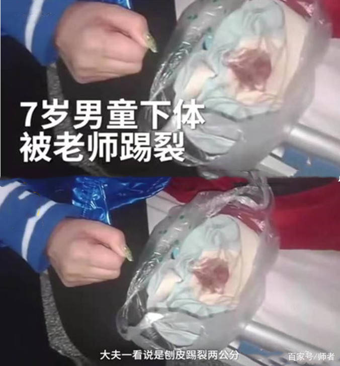 男孩课堂不听话,被女教师拉出去一脚踢在裆部,家长出离愤怒了