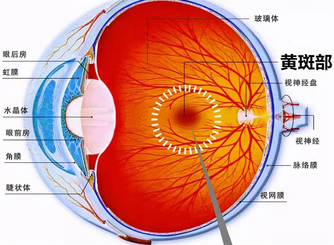 中科眼吧||眼睛发生黄斑病变,离不开这5个原因