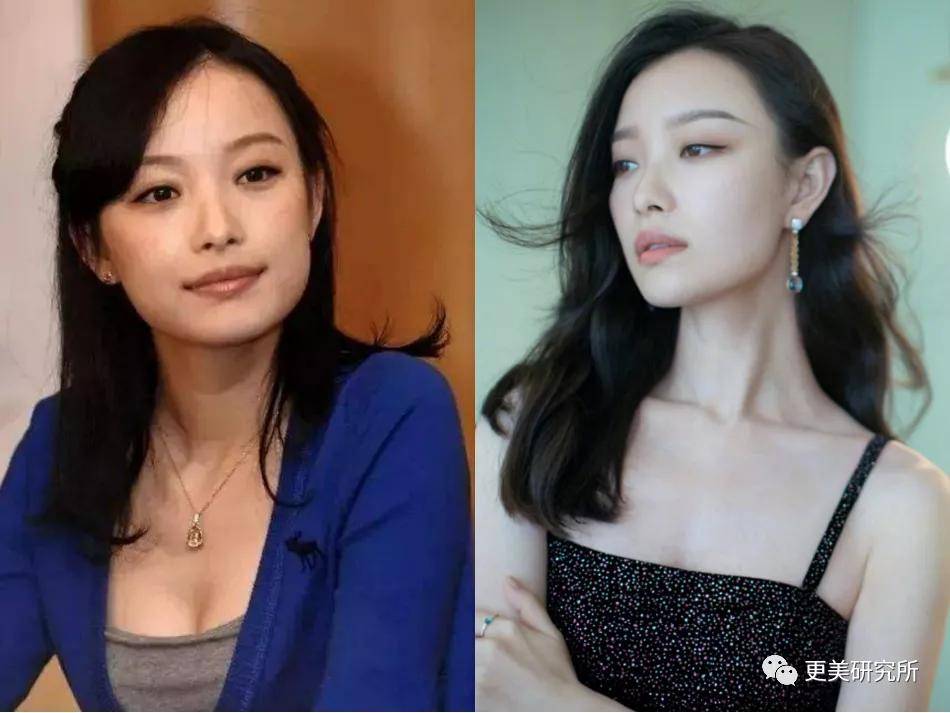 像倪妮,早期喜欢佝偻着肩,显小家子气,现在已经逆袭 天鹅颈气质挂美人