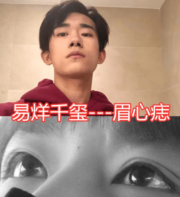有种"锦上添花"叫明星的痣,白敬亭泪痣,看到眉心痣:沦陷了!_肖战