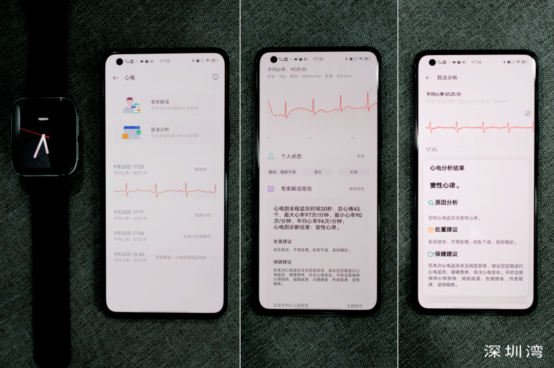 问题|苹果侵犯心电专利，Fitbit硬件出问题，三星、华为一波三折，ECG 手表怎么了？