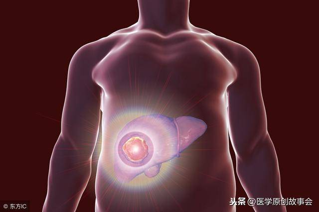 什么药对恶性腹水有帮助 7003b7b62fad4a02b4d3b60bdcfdad27.jpeg
