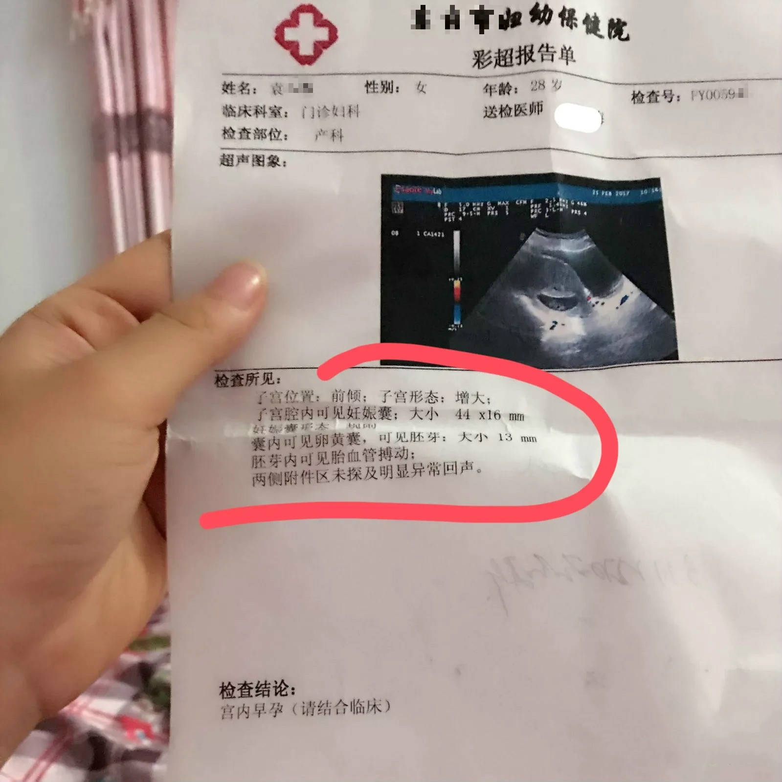 试管婴儿怀孕感染弓形虫的话会导致打胎吗?