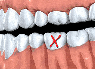 2fc6e8d89ed1470eb0249d6b4ecc0205.gif