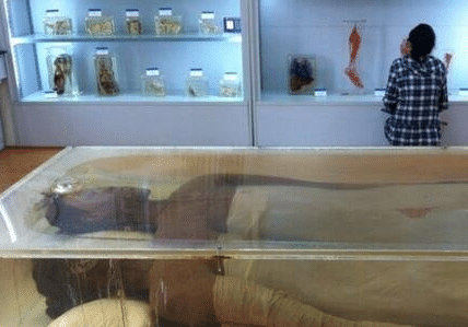 世界第一女巨人曾金莲:14岁高过姚明,18岁猝死,遗体至今未下葬
