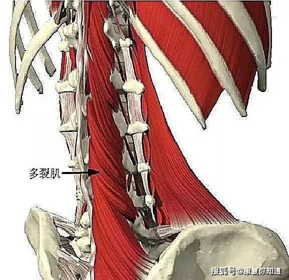 什么肌肉容易引发脊柱侧弯?