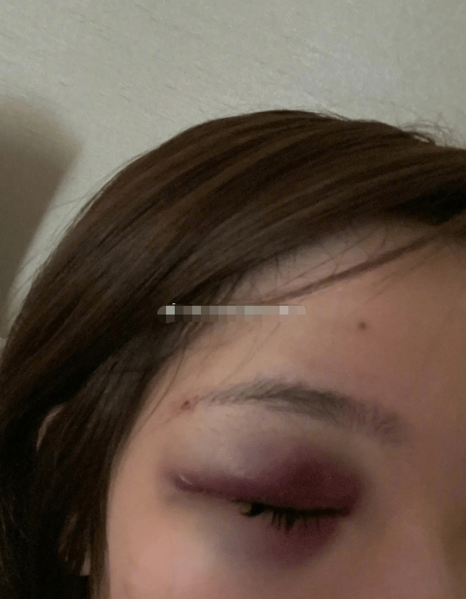 声称自己遭到屈楚萧的殴打,还有一些自己被打的鼻青脸肿的自拍照.
