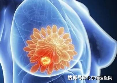 
为什么中国女人更容易患乳腺癌？真相却是……_新京葡萄官方网站