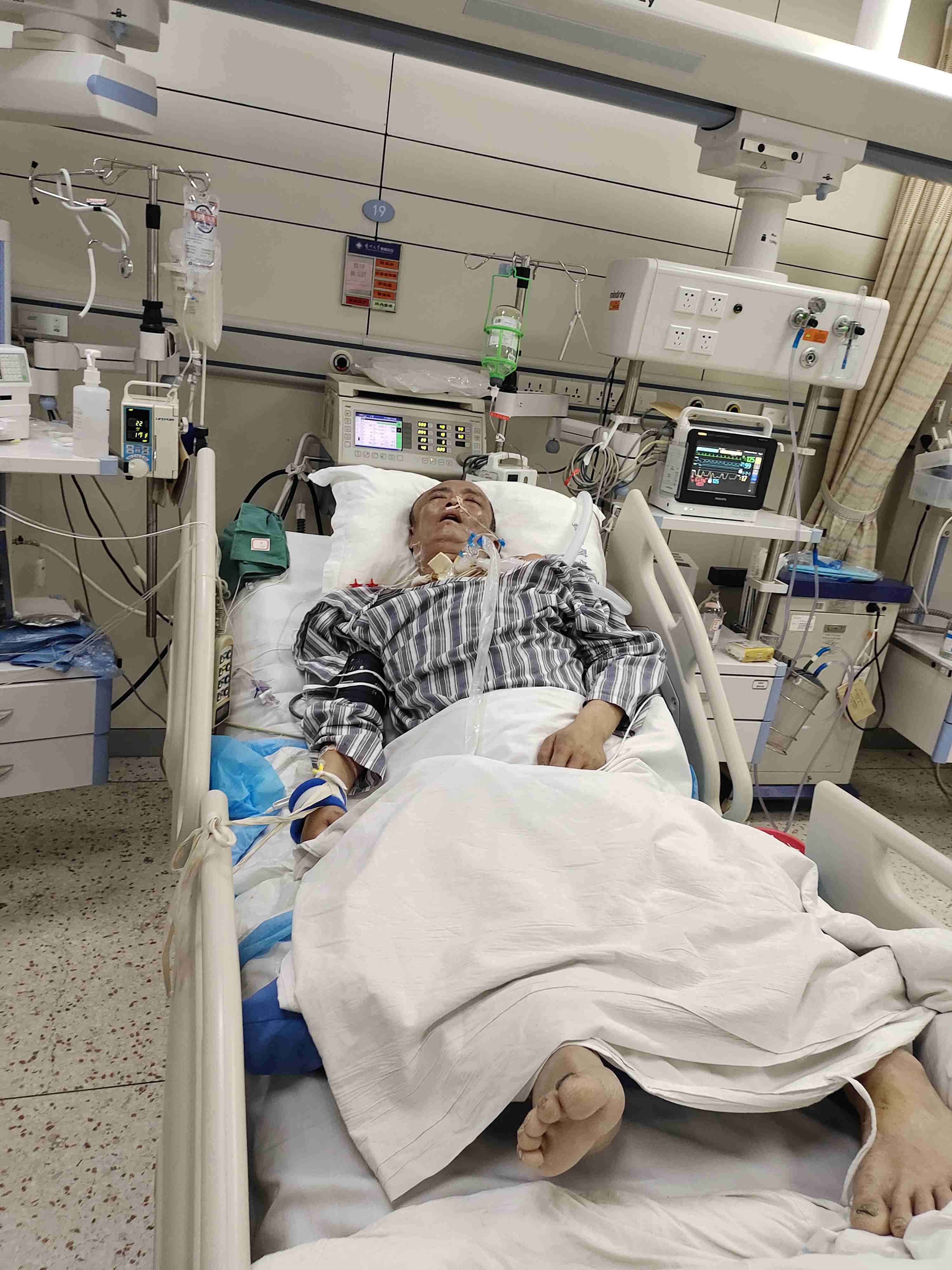 泰安51岁顶梁柱父亲异地突发脑出血,开颅手术后进icu