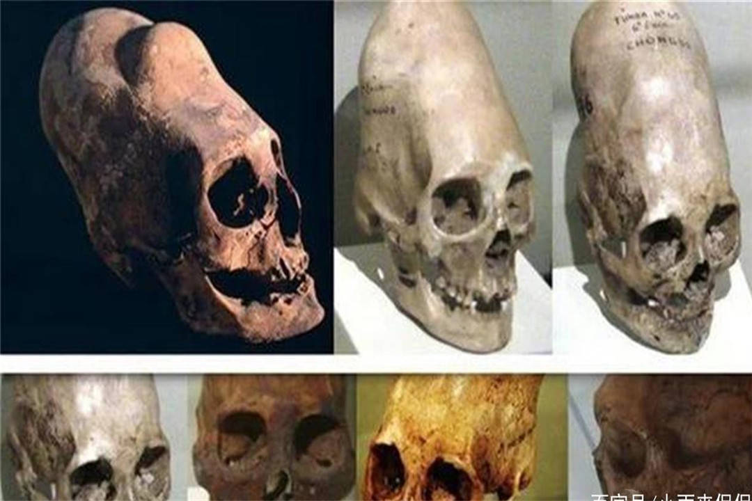 原创外星人真的存在吗?狭长形状的头骨,基因检测出了什么?