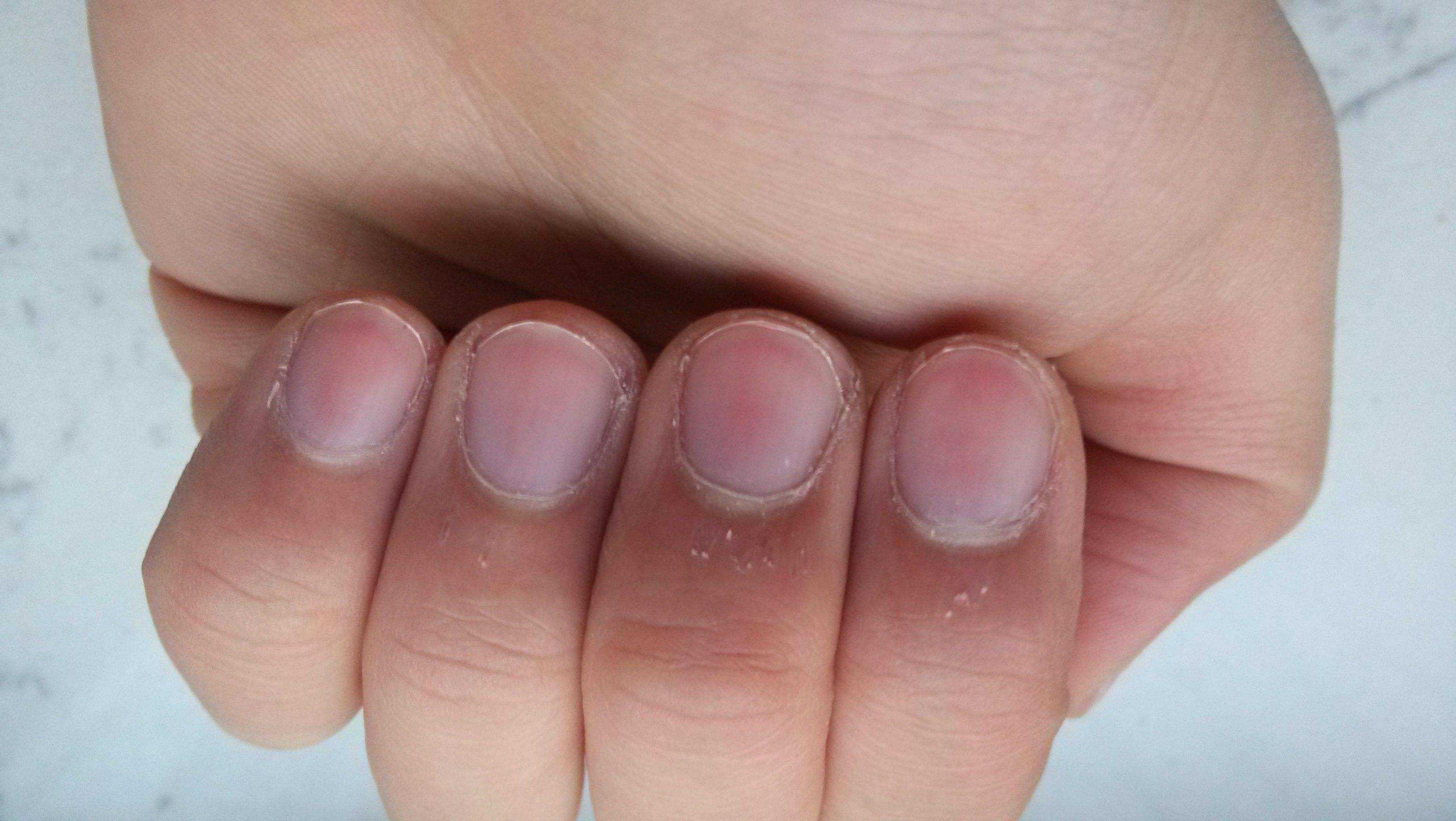 指甲上的月牙到底是什么和身体的好坏又有什么关系呢