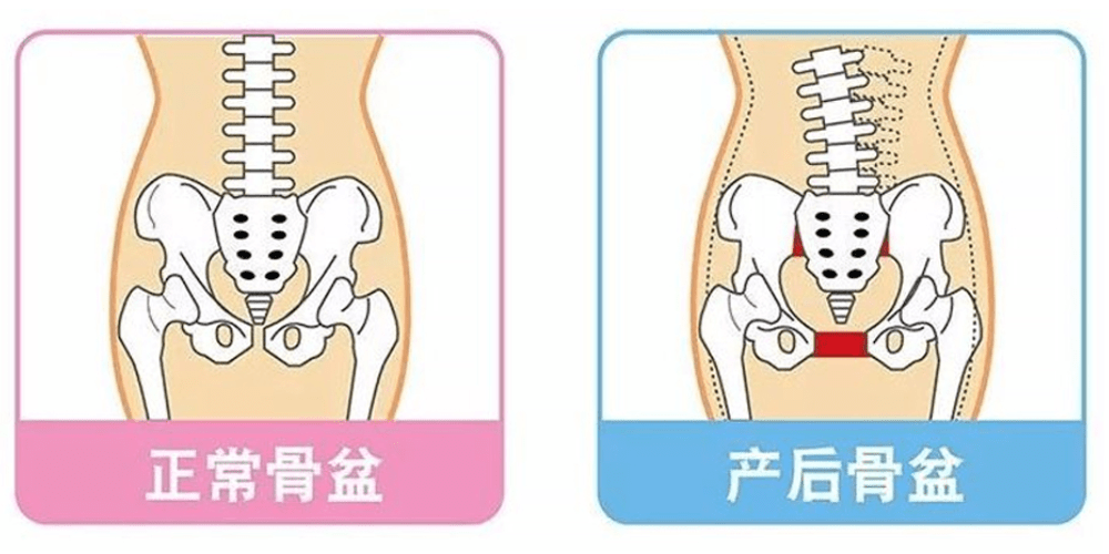 没人告诉你生完孩子后,这4处器官会移位,变形!如何恢复?速看