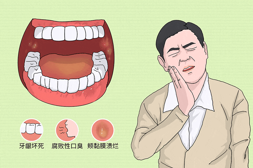 一般症状表现为口腔内舌边,上颚,口颊,齿龈等处发生溃疡,周围红肿作痛