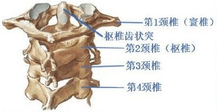 头颈疼痛歪斜为哪般寰枢椎脱位要警惕