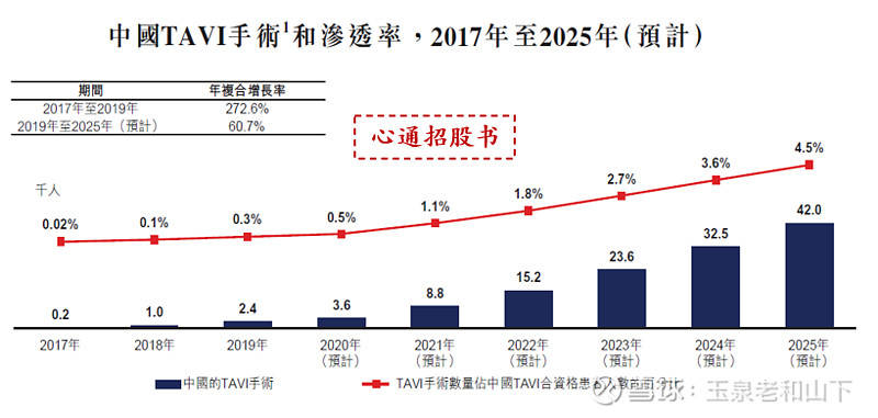 深度解析：微创心通，未来还有多少增长空间？