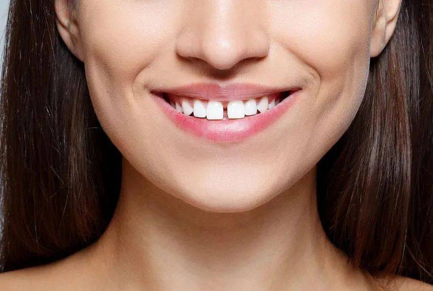 牙齿稀疏矫正后牙齿会歪吗?