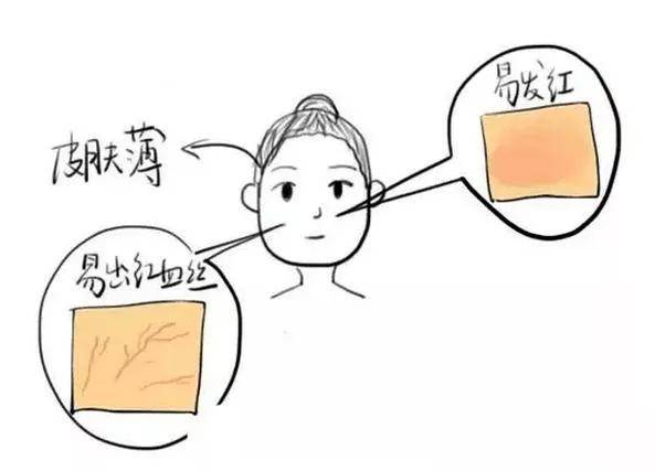 为什么觉得自己很敏感 fd267ac5f5334354963abb4121e7831a.jpeg