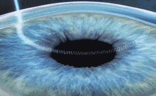 37ee7c51a30540b9bce30b2afb06d652.gif