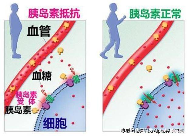 胰岛素越用越多血糖却控制不好