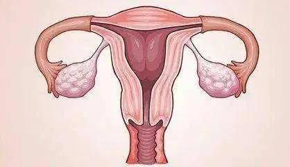 子宫内膜薄怎么办?