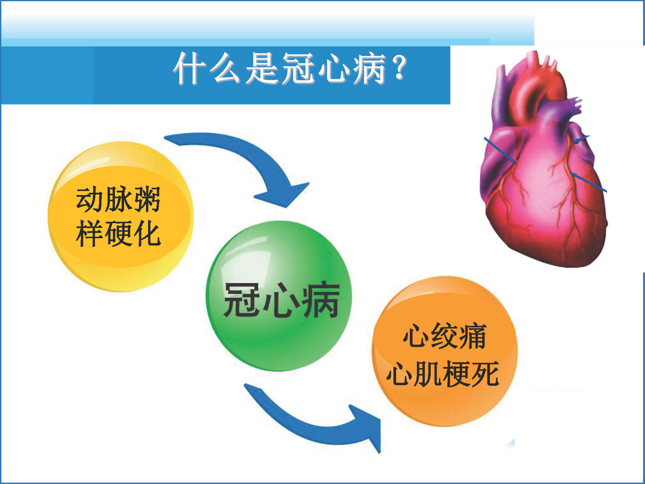 【图解】冠心病心肌梗死的诱因?