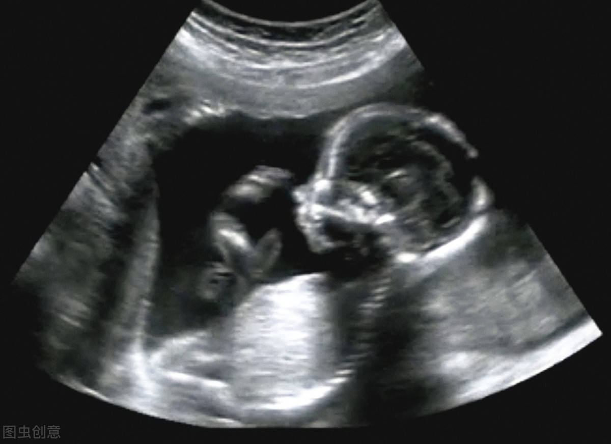 原创孕期四维彩超4种方法让宝宝高度配合一次顺利过关