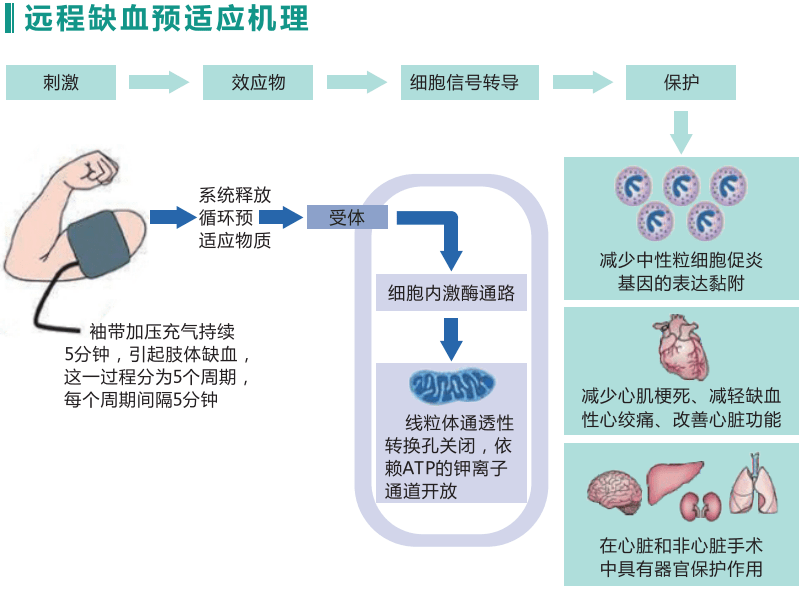 脑心健缺血预适应训练仪具有主动脉血管堵塞及心血管健康筛查预警