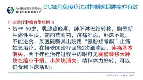 刘向善树突细胞dc免疫疗法治疗各种实体瘤取得确切疗效