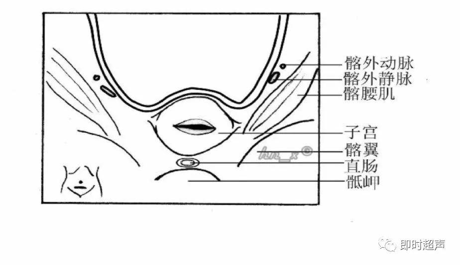 图2-4-1 经子宫体横切面盆腔内结构示意图