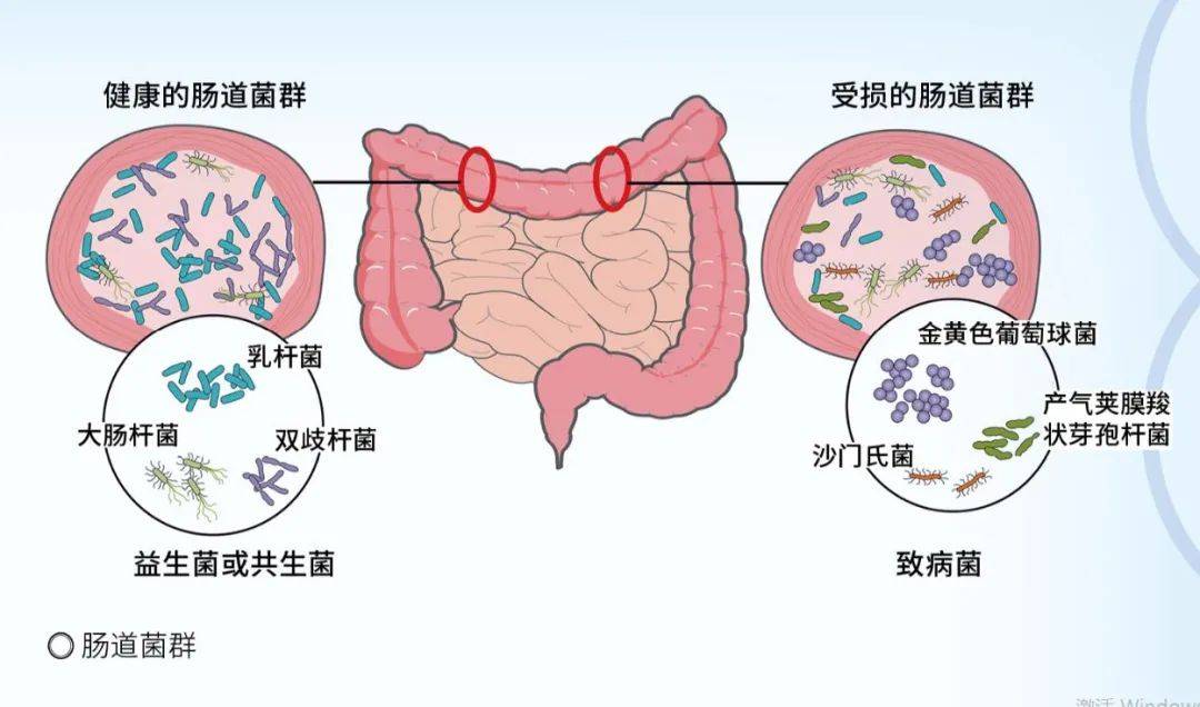 决定你胃口的不是你的胃,而是肠道微生物!