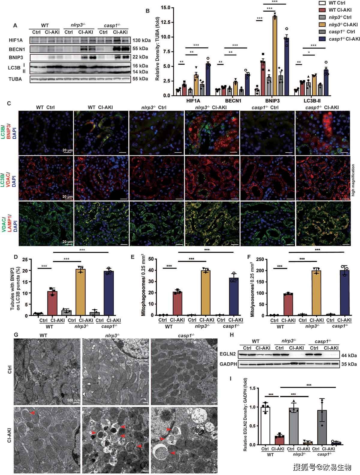 项目文章autophagy线粒体自噬缓解急性肾损伤的分子机制