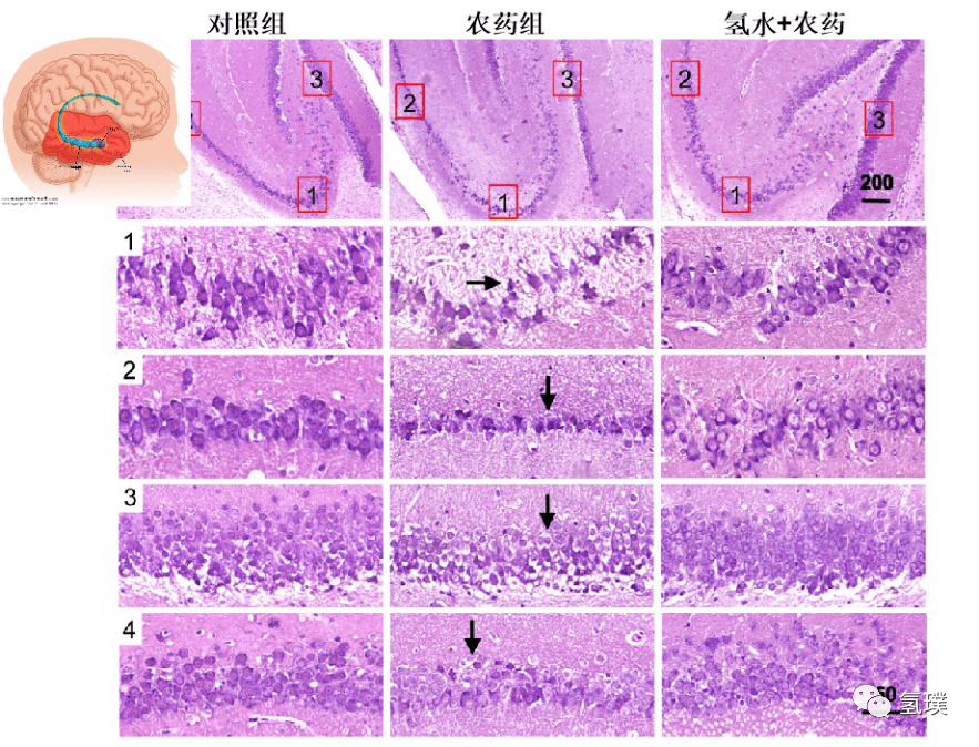 尼氏染色检测cpf对大鼠脑海马区神经元的损伤及氢的保护作用 wang t