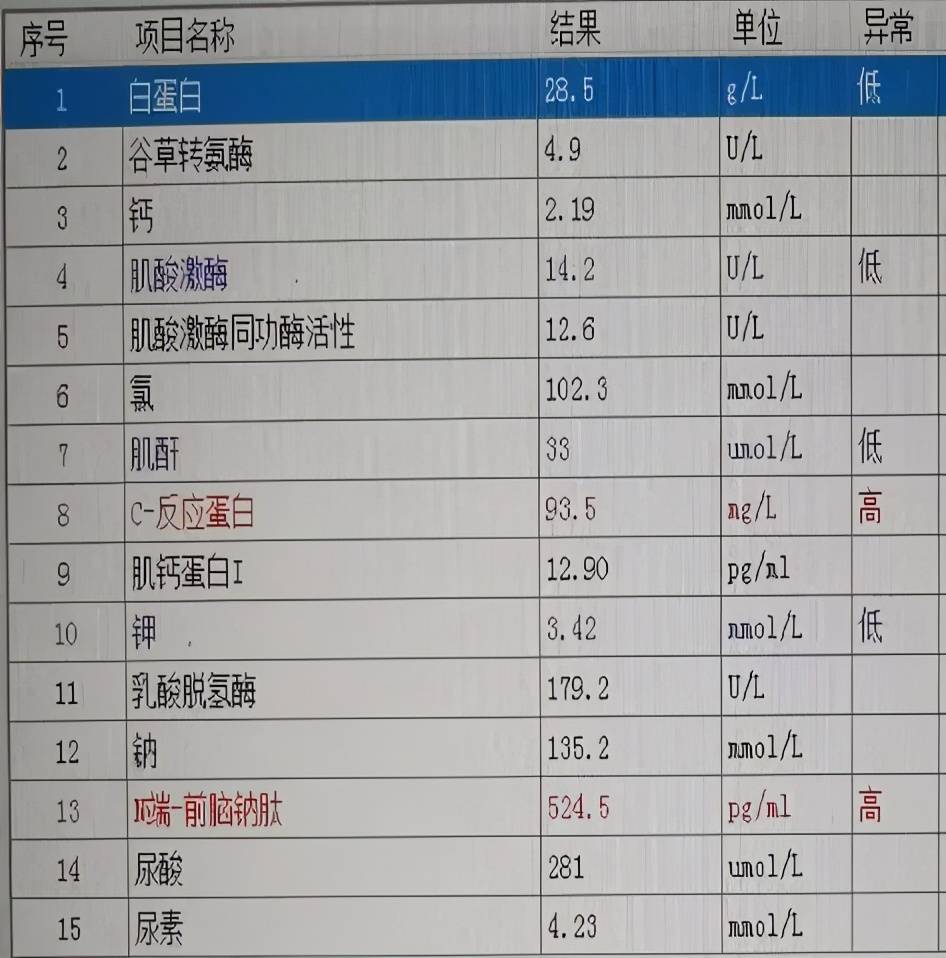 血生化血常规辅助检查糖尿病足(texas 3b,左足,2 型糖尿病.