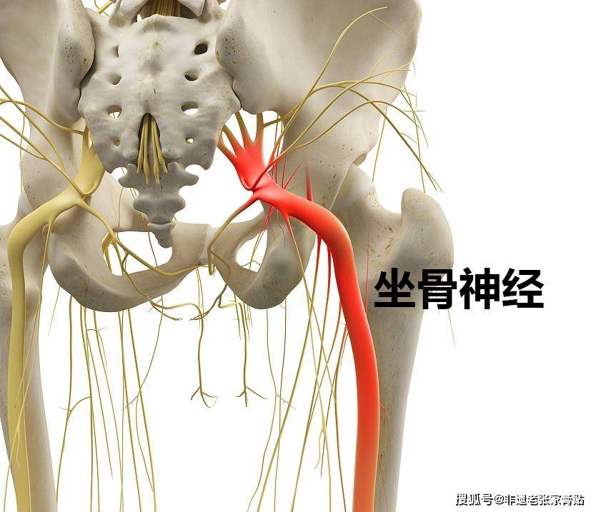 原创非遗老张家膏贴腰部疼痛双腿麻木是坐骨神经痛吗